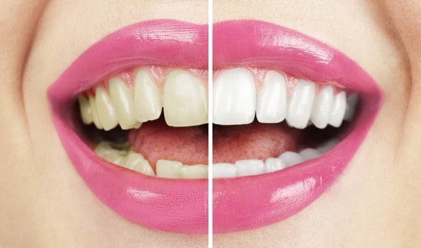 What Early Signs of Oral Cancer Should You Never Ignore Bognor Regis?