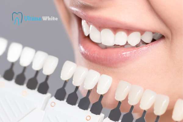 How to Maximise the Results of Your Laser Teeth Whitening Treatment Bognor Regis
