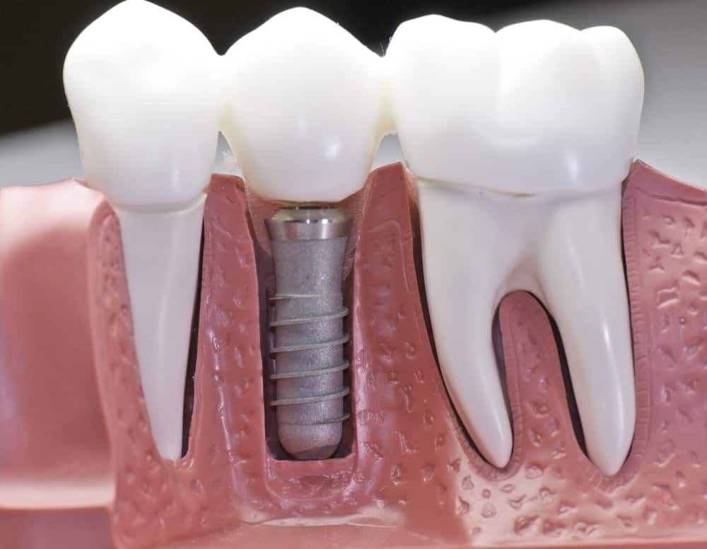 Common Misconceptions About Modern Dental Treatments Bognor Regis