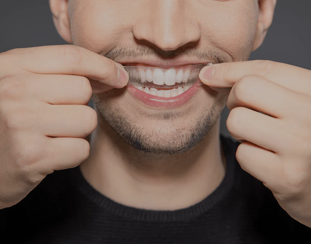 What to Consider Before Choosing a Teeth Whitening Option Bognor Regis