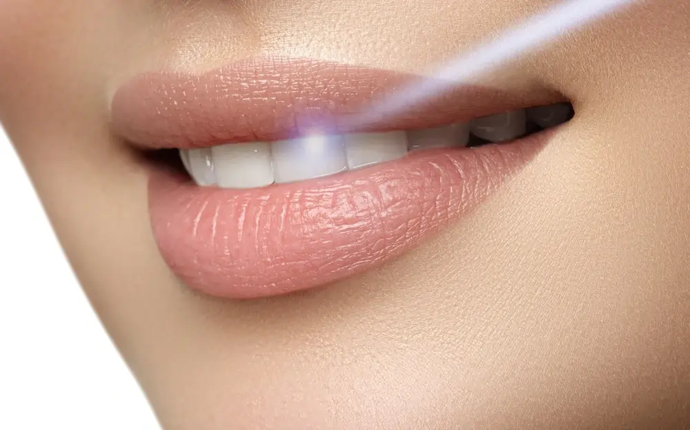 Understanding Teeth Whitening Risks and Results Bognor Regis
