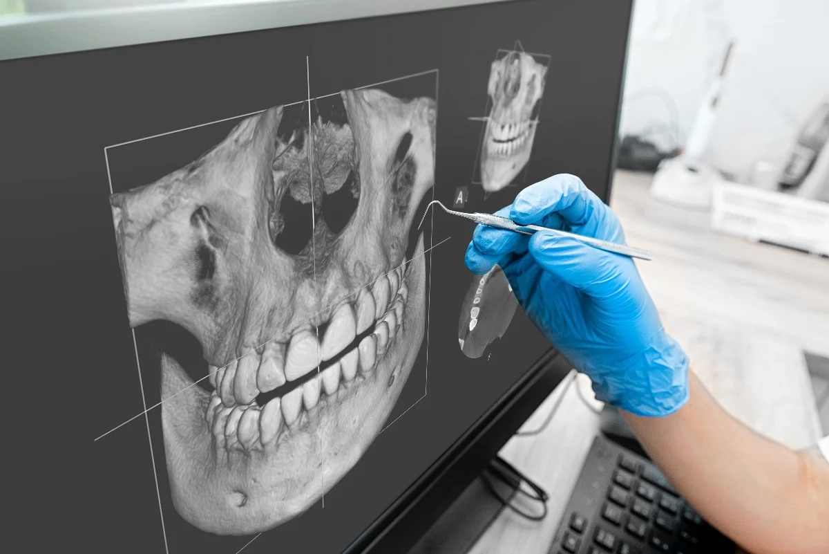 How Is AI Transforming Dental Treatment Planning Bognor Regis?