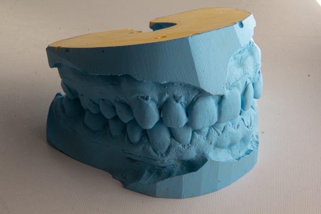 How Do Dental Implants Improve Jawbone Health and Oral Function Bognor Regis?