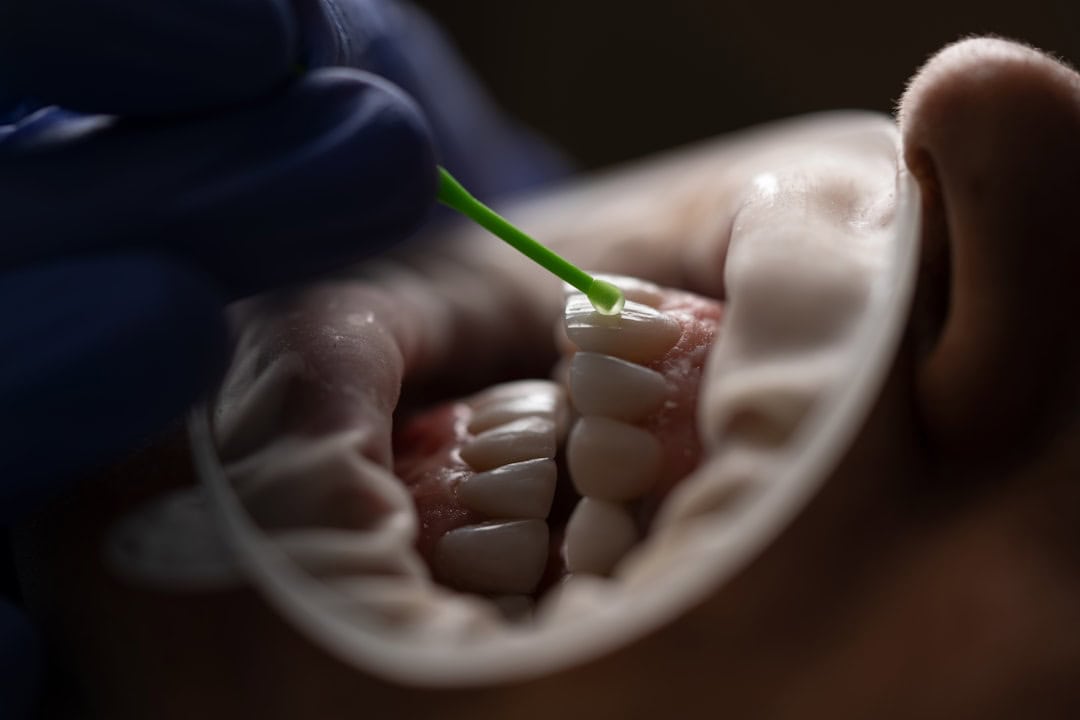 Common Causes of Persistent Dry Mouth Bognor Regis