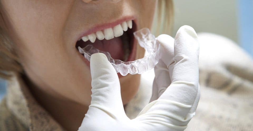 Can Bruxism Affect Your Sleep Quality Bognor Regis