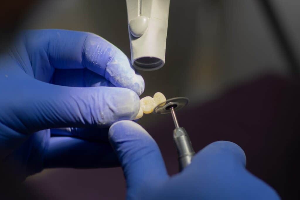 Customised Dental Solutions: Crowns, Aligners, and Implants Bognor Regis