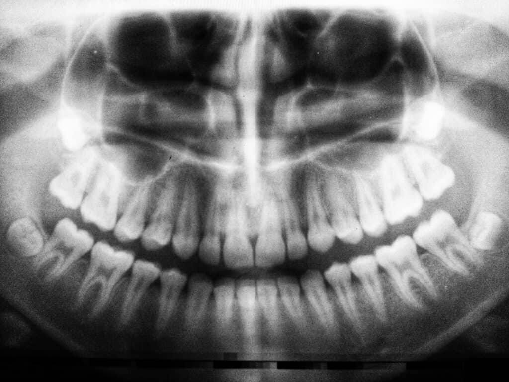 The Future of 3D Printing in Oral Healthcare Bognor Regis