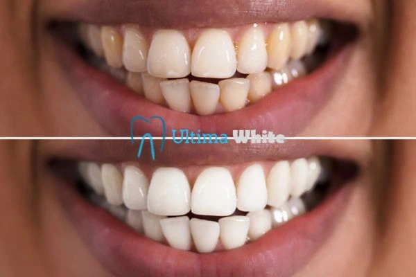 Long lasting results from Ultima White Bognor Regis